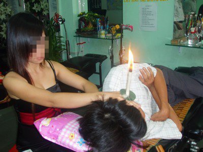 Dính bệnh vì 'thú vui' từ tiệm hớt tóc
