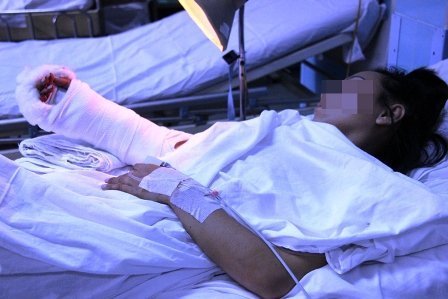 Bắt băng nhóm chém lìa tay cô gái cướp xe SH