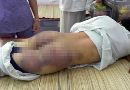 Bị đánh bầm dập vì 'gây sự' với trưởng công an xã