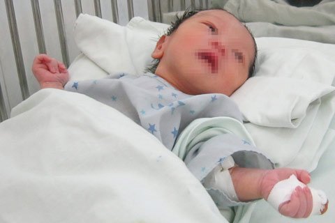 Bí ẩn đằng sau vụ mẹ cắn đứt ngón tay con mới sinh