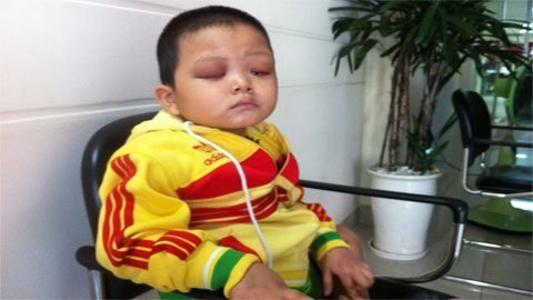 Con em mà mù thì…niềm hy vọng cuối cùng cũng mất