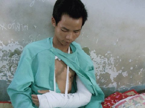 Chặt lìa tay, cướp Iphone ngay trước nhà