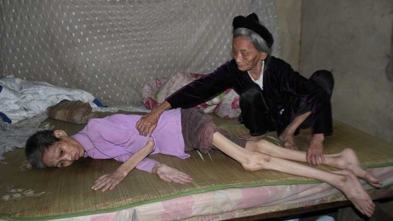 Xót thương gia đình chồng tâm thần mù lòa, vợ liệt tứ chi