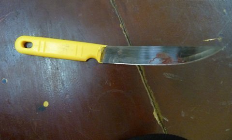 Táo tợn cầm dao đâm vào đầu tài xế cướp tiền