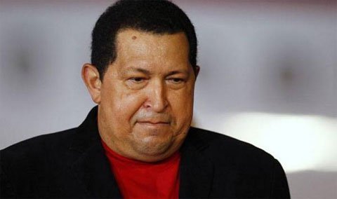 Chavez bị biến chứng nghiêm trọng