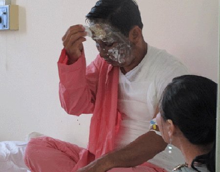 Ghen tuông, vợ nấu nước sôi “luộc” chồng