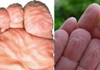 Vì sao ngón tay nhăn nheo khi ngâm nước?