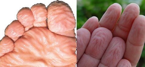 Vì sao ngón tay nhăn nheo khi ngâm nước?