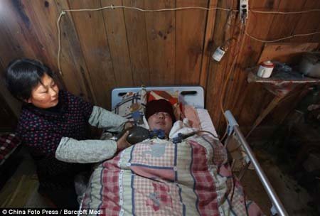 Sống sót 5 năm nhờ máy thở tự chế