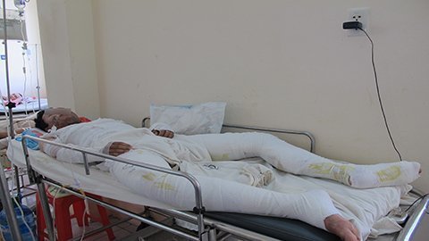 Ăn tất niên, bị bếp cồn làm phỏng toàn thân