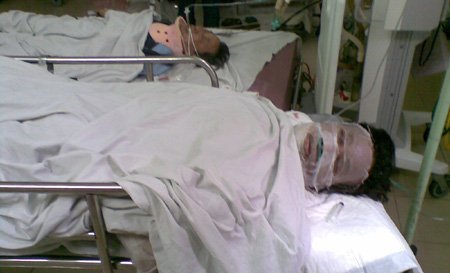 Giận vợ, đổ xăng thiêu chết 2 con gái