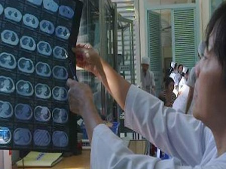 Nhiều trẻ bị hóc dị vật dịp Tết