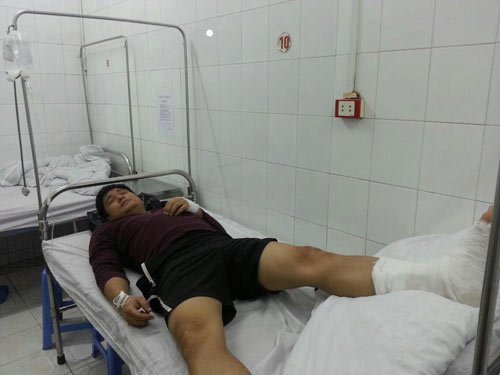 Minh Tiệp nhập viện vì ngã ngựa