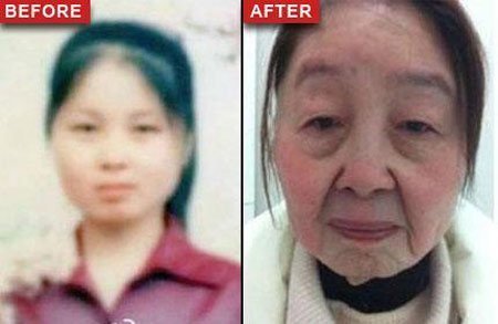 Cô gái 28 tuổi biến thành bà lão sau khi sinh