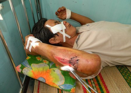 Lão nông truy đuổi, bắt gọn 2 tên cướp