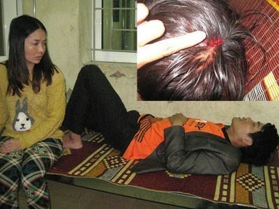 Bức xúc, GĐ chi nhánh ‘tẩn’ sếp nhập viện