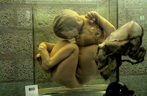 Bảo tàng rùng rợn nhất thế giới