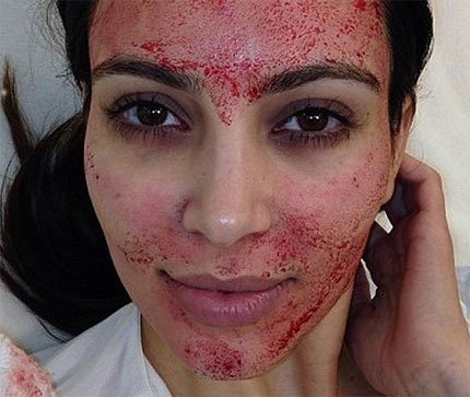 Làm đẹp gây sốc bằng... 