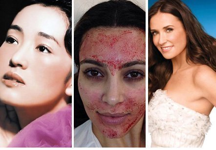 Những kiểu làm đẹp rợn người của Sao