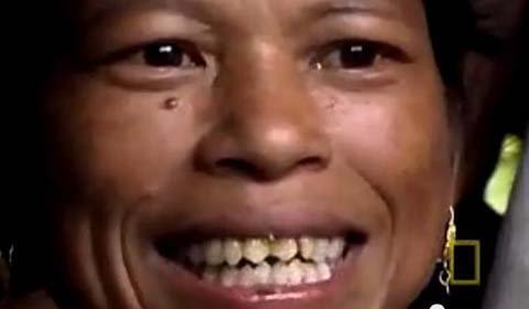 Ở nơi đàn ông thích phụ nữ răng nhọn