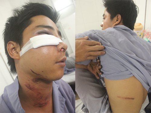 GĐ công an HN yêu cầu làm rõ vụ 141 bị 'tố' đánh dân