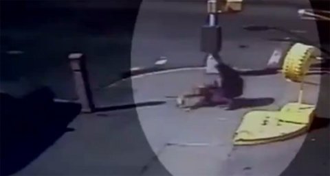 Bé gái bị chó cắn dữ dội