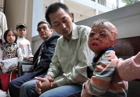 Phẫn nộ những án mạng dùng xăng thiêu đốt người thân