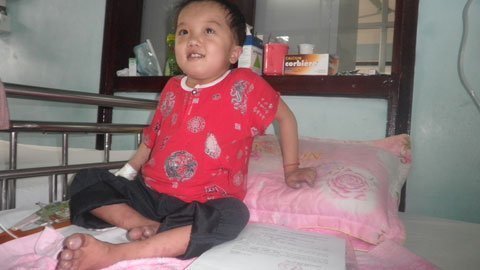 Đôi mắt lồi thiếu thốn của cậu bé người Dao