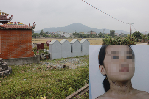 Bố đẻ, mẹ kế đánh con gái tàn nhẫn, đuổi ra nghĩa địa