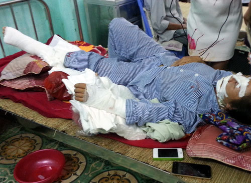 Chồng tra tấn vợ dã man ngay giữa đường