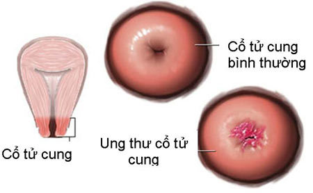 Xét nghiệm mới tìm bất thường sản