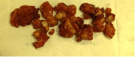 Suýt mất ‘vòng 3’ vì silicon vón cục