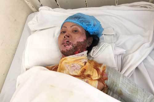 Nếu không tiếp tục điều trị thì cô ấy chết mất