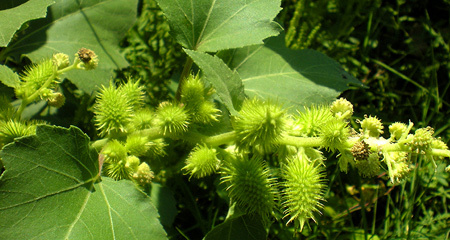 Viêm xoang mạn tính - đừng ‘đổ thừa’ cho mũi