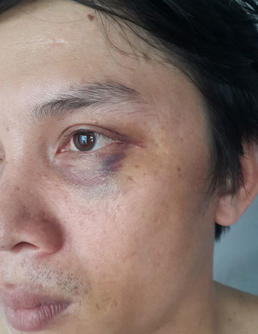 Phóng viên báo Hà Nội Mới tố bị hành hung khi tác nghiệp
