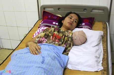 Nữ du khách bị hổ cắn đứt cánh tay xuất viện