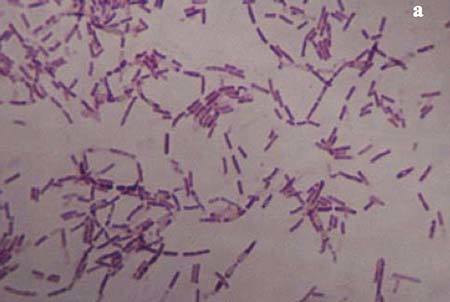 Bằng chứng mới về vi khuẩn có thể giúp người bất tử