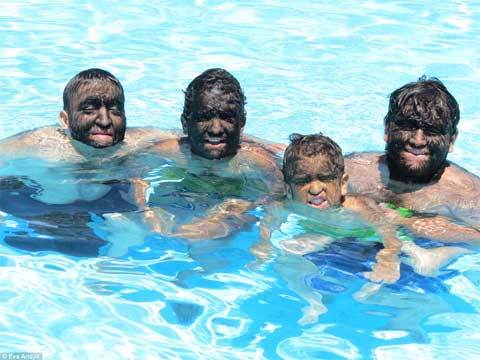 Điều ít biết về gia đình 'người sói' nổi tiếng thế giới