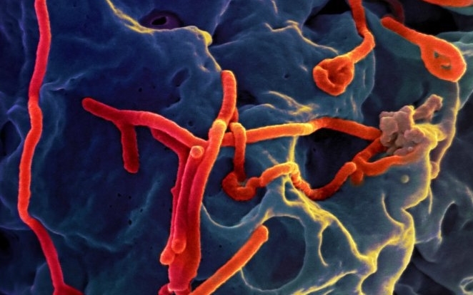 Nguy cơ Ebola tái phát trên cơ thể người khỏi bệnh