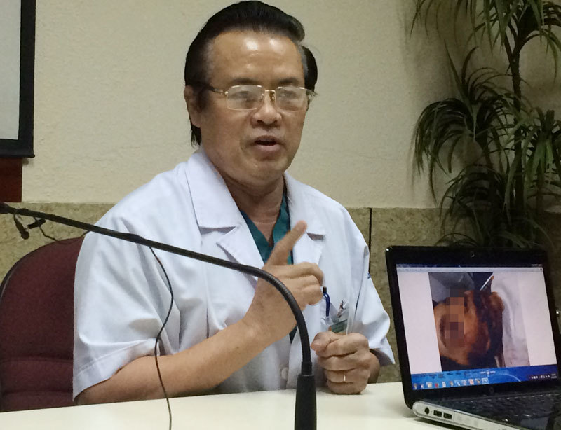 Bé gái 8 tuổi bị chó cắn nát mặt, khâu mất 7,5m chỉ