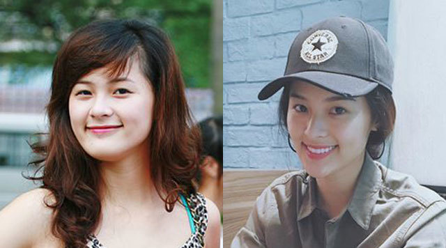 Tình mới của Cường Đô la bị nghi ngờ nhờ đến dao kéo