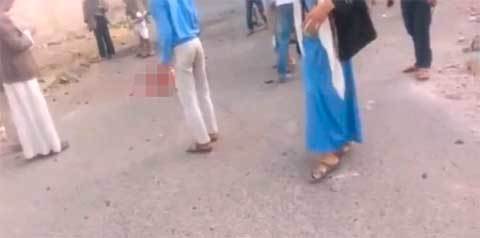 Kẻ đánh bom IS vẫn sống sau khi mất nửa người