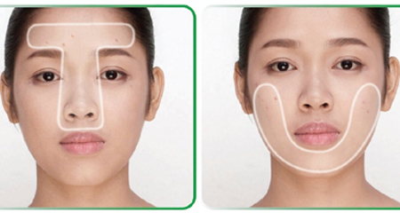 Điều trị mụn tuổi trưởng thành