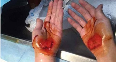 Giáo viên thể dục phạt học sinh đi bằng tay tóe máu