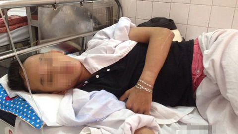 Nạn nhân 'thoi thóp' kể lại vụ truy sát kinh hoàng