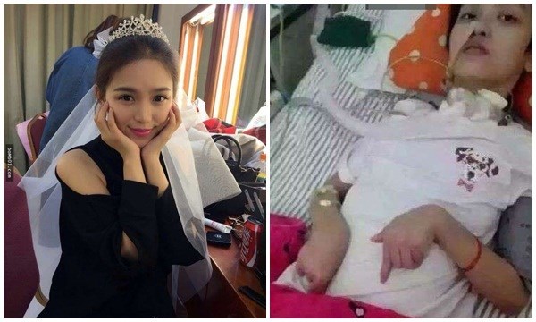 Cô gái xinh đẹp biến thành dị dạng sau một lần thổi nến