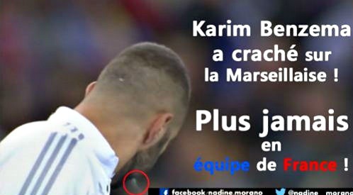 Benzema nhổ nước bọt khi hát quốc ca Pháp