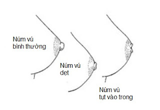 Thanh tra tỉnh Nghệ An: Hủy kết quả cán bộ xã trúng đấu giá 23 lô đất là hơi vội