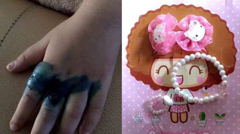 Nhiễm trùng vì đeo nhẫn đồ chơi