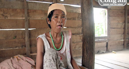 Chuyện buồn mang tên 'ma lai', 'thuốc thư'
